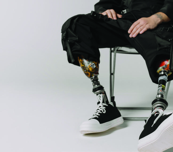 A seated person wearing two lower-limb prostheses and black trainers
